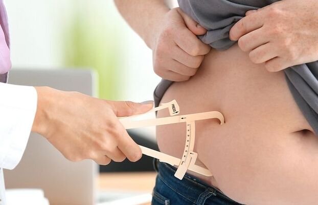 Cirurgia bariátrica