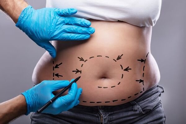 planejamento financeiro para cirurgia plástica